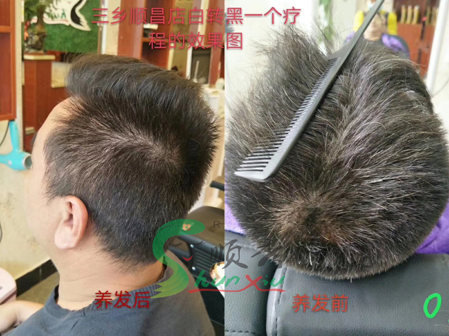 白发转黑--2（1）