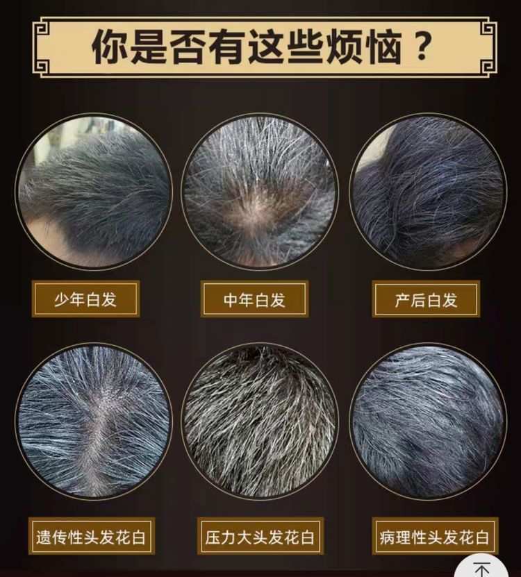白发烦恼
