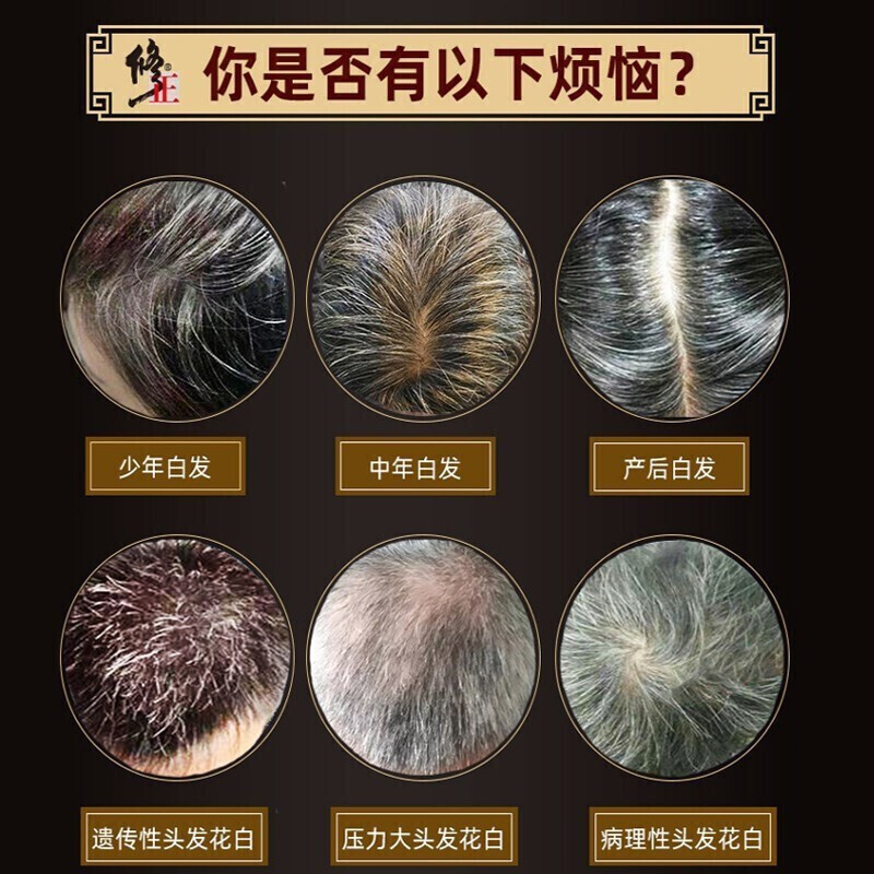 白发1